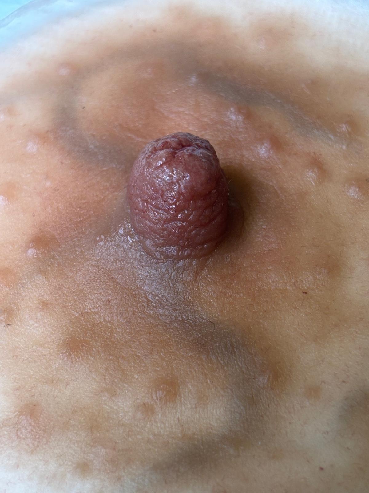 Close-up of a handcrafted nipple prosthetic showing realistic 3D detail